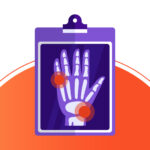 Profesionales del Instituto William Osler analizan estudios para el diagnóstico temprano de la Enfermedad de Gaucher y sus avances en tratamiento.